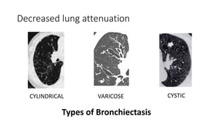 Computed tomography of thorax basics and its interpretation (1) | PPTX