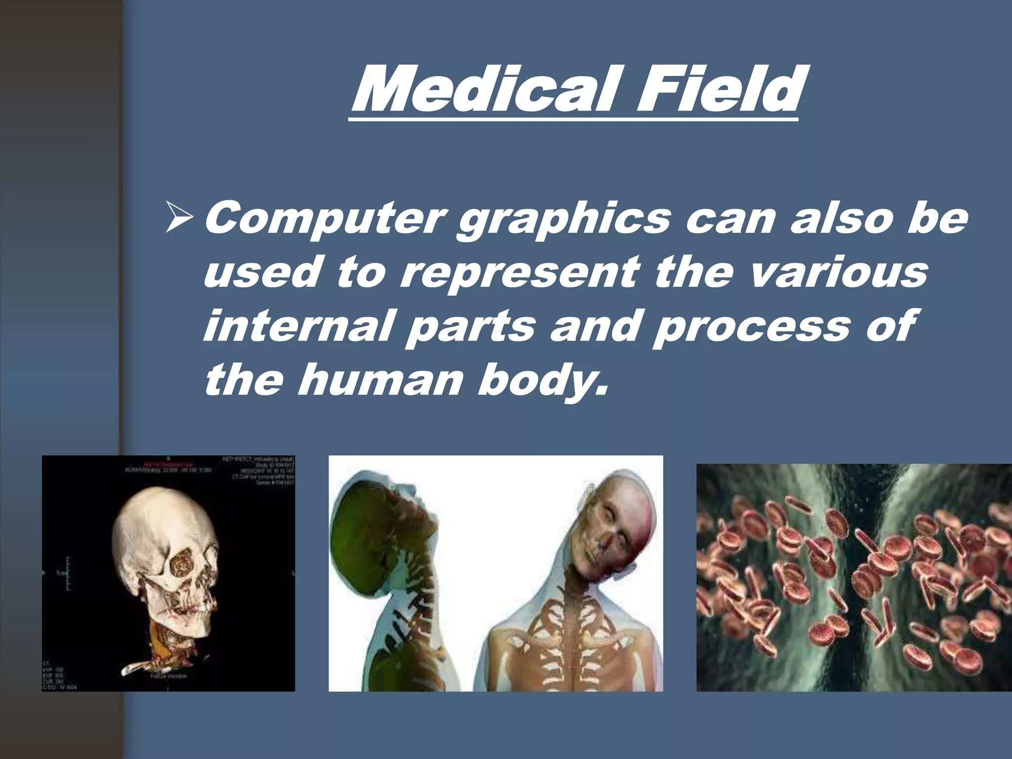 Medical Field
Computer graphics can also be
used to represent the various
internal parts and process of
the human body.
 