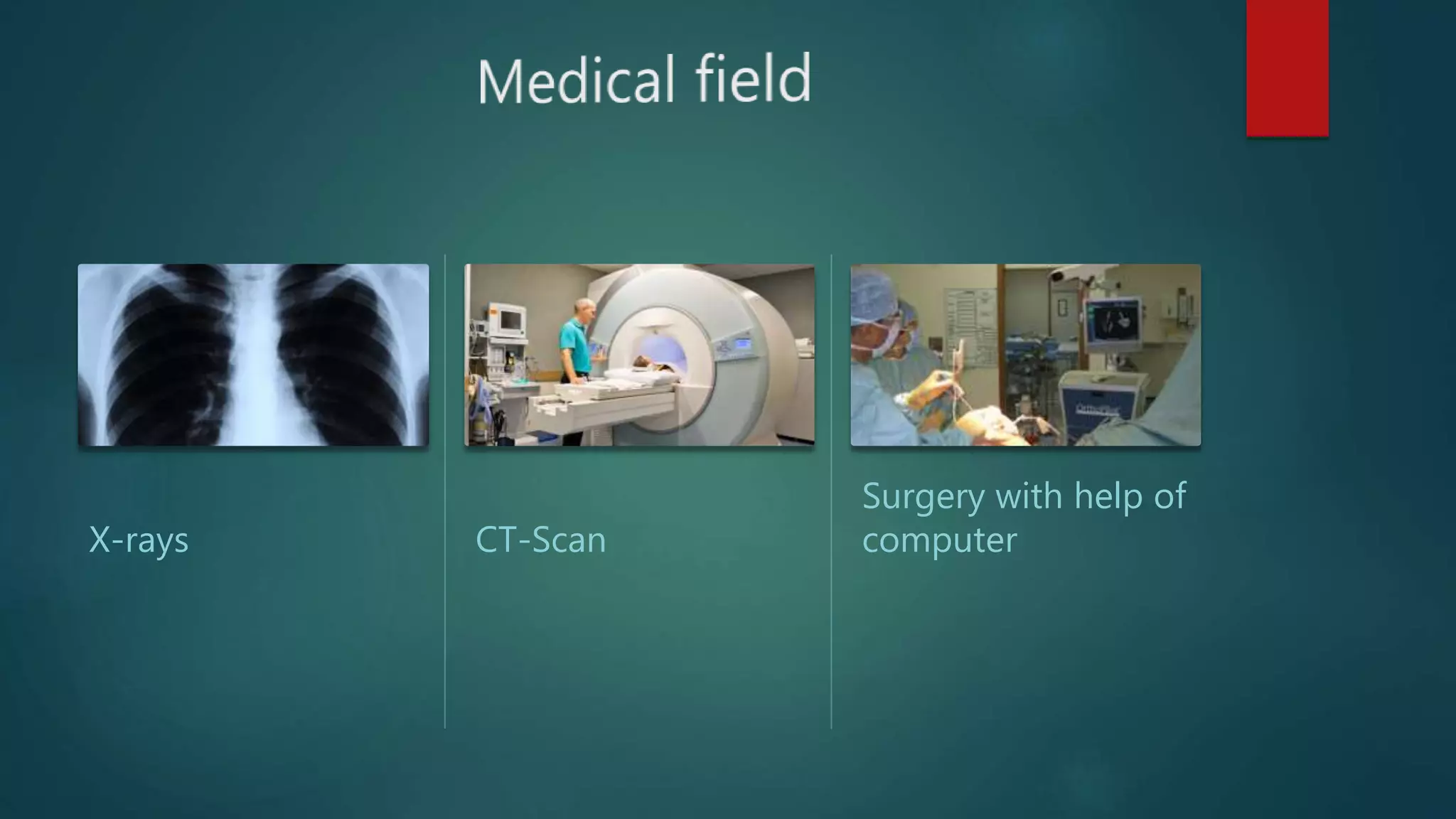 X-rays CT-Scan
Surgery with help of
computer
 