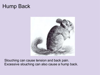Hump Back Slouching can cause tension and back pain. Excessive slouching can also cause a hump back. 