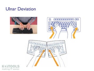 Ulnar Deviation 