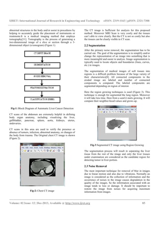 IJRET: International Journal of Research in Engineering and Technology eISSN: 2319-1163 | pISSN: 2321-7308
__________________________________________________________________________________________
Volume: 02 Issue: 12 | Dec-2013, Available @ http://www.ijret.org 85
abnormal structures in the body and/or assist in procedures by
helping to accurately guide the placement of instruments or
treatments.It is a medical imaging method that employs
tomography[11]. Tomography is the process of generating a
two-dimensional image of a slice or section through a 3-
dimensional object (a tomogram) (Figure 1).
Fig-1: Block Diagram of Automatic Liver Cancer Detection
CT scans of the abdomen are extremely helpful in defining
body organ anatomy, including visualizing the liver,
gallbladder, pancreas, spleen, aorta, kidneys, uterus,
andovaries.
CT scans in this area are used to verify the presence or
absence of tumors, infection, abnormal anatomy, or changes of
the body from trauma. The Original chest CT image is shown
(Figure 2).
Fig-2: Chest CT image
The CT image is Sufficient for analysis for this proposed
method. Moreover MRI Scan is very costly and the tissues
can’t able to view clearly. But the CT is not so costly but also
the tissues can be clearly visible in CT scan.
2.2 Segmentation
After the primary noise removal, the segmentation has to be
carried out. The goal of the segmentation is to simplify and/or
change the representation of an image into something that is
more meaningful and easier to analyze. Image segmentation is
typically used to locate objects and boundaries (lines, curves,
etc.) in images.
The segmentation of medical images of soft tissues into
regions is a difficult problem because of the large variety of
their characteristics[8]. All connected components in the
eroded image are labeled and number of connected
components is computed. The labeled components are
segmented depending on region of interest.
Here the region growing techniques is used (Figure 3). This
technique is enough for segmented the lung region. Moreover
it will take less time. Here from a seed it starts growing. It will
compare their neighbor-hood values and grows up.
Fig-3:Segmented CT image using Region Growing
The segmentation process will result in separating the liver
tissue from the rest of the image and only the liver tissues
under examination are considered as the candidate region for
detecting tumor in liver portion.
2.3 Noise Removal
The most important technique for removal of blur in images
due to linear motion and also due to vibrations. Normally an
image is considered as the collection of information and the
occurrence of noises in the image causes degradation in the
quality of the images. So the information associated with an
image tends to loss or damage. It should be important to
restore the image from noises for acquiring maximum
information from images.
 