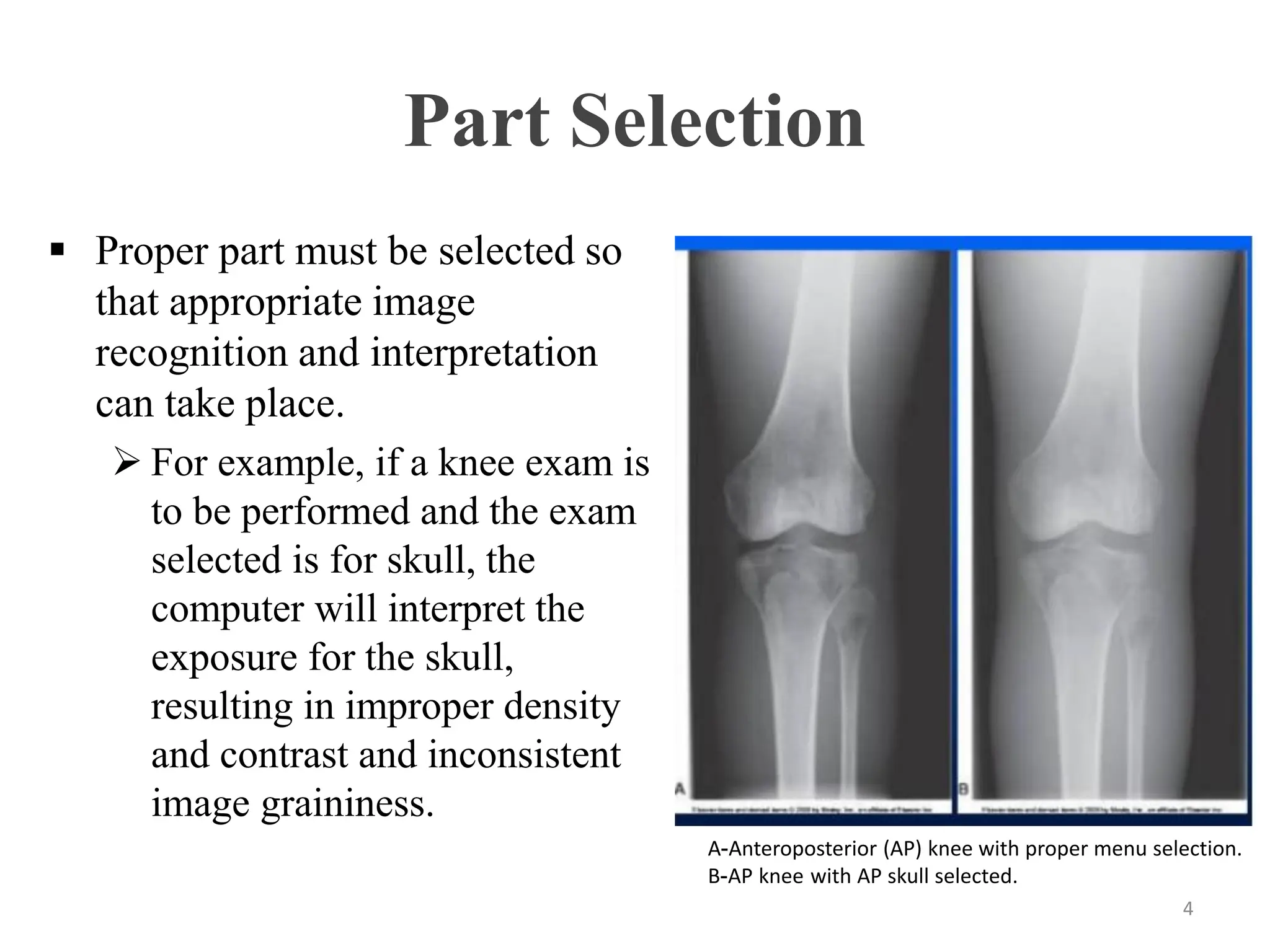 Computer application in Radiology - lec -5.pdf