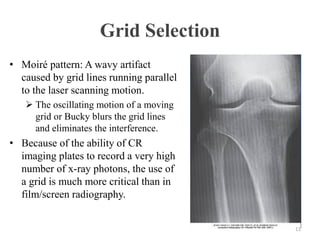 Computer application in Radiology - lec -5.pdf