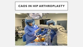 CAOS IN HIP ARTHROPLASTY
 