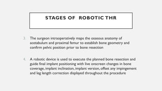 3. The surgeon intraoperatively maps the osseous anatomy of
acetabulum and proximal femur to establish bone geometry and
confirm pelvic position prior to bone resection
4. A robotic device is used to execute the planned bone resection and
guide final implant positioning with live onscreen changes in bone
coverage, implant inclination, implant version, offset any impingement
and leg length correction displayed throughout the procedure
STAGES OF ROBOTIC THR
 