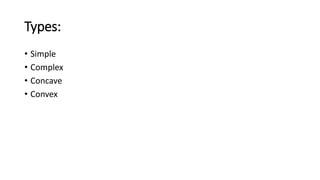 Types:
• Simple
• Complex
• Concave
• Convex
 