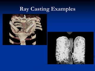 Ray Casting Examples
 