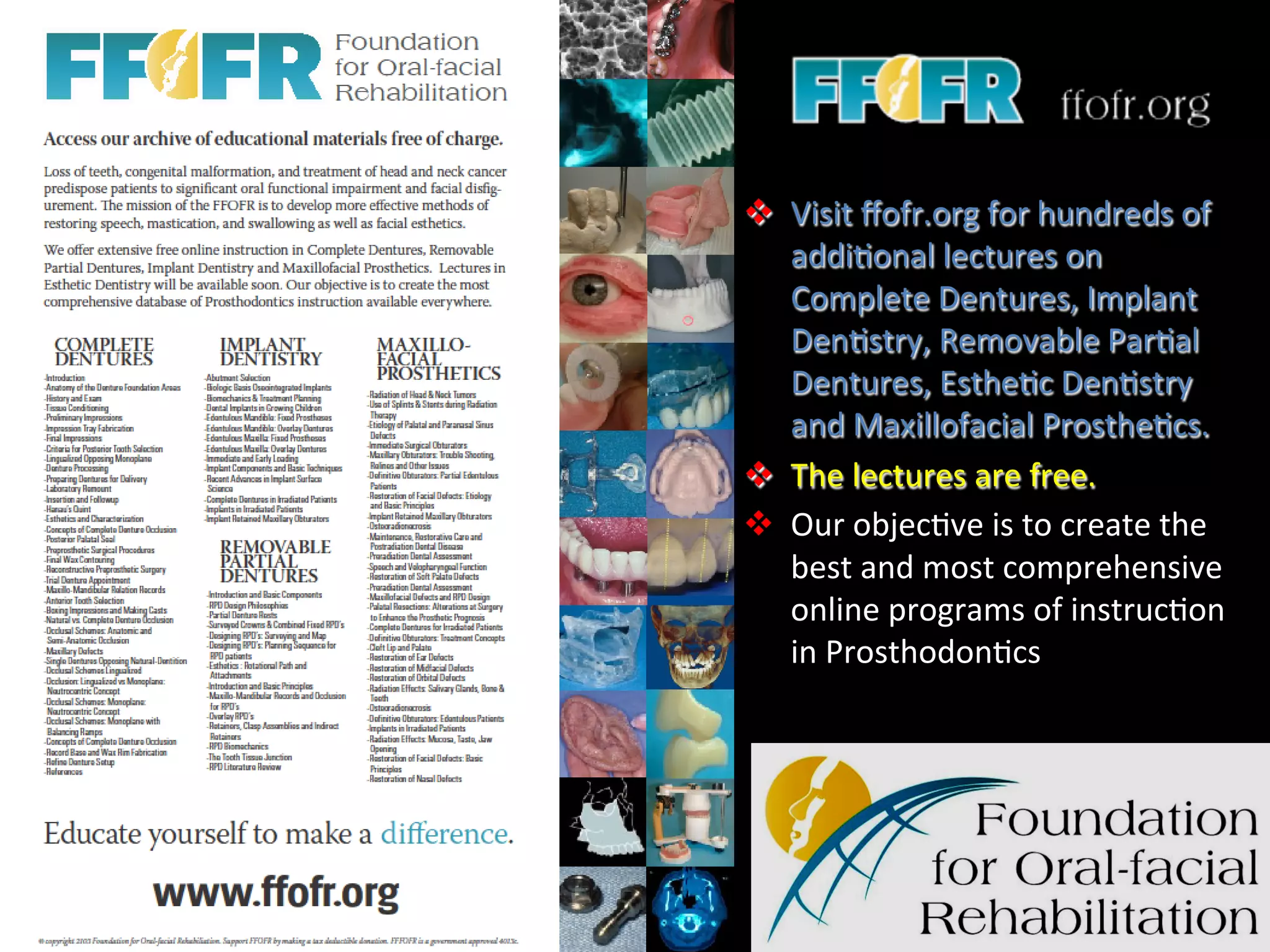 v  Visit	
  ﬀofr.org	
  for	
  hundreds	
  of	
  
addi1onal	
  lectures	
  on	
  
Complete	
  Dentures,	
  Implant	
  
Den1stry,	
  Removable	
  Par1al	
  
Dentures,	
  Esthe1c	
  Den1stry	
  
and	
  Maxillofacial	
  Prosthe1cs.	
  
v  The	
  lectures	
  are	
  free.	
  	
  
v  Our	
  objec1ve	
  is	
  to	
  create	
  the	
  
best	
  and	
  most	
  comprehensive	
  
online	
  programs	
  of	
  instruc1on	
  
in	
  Prosthodon1cs	
  
 