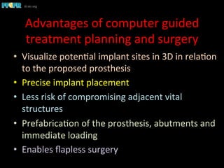 Advantages	
  of	
  computer	
  guided	
  
treatment	
  planning	
  and	
  surgery	
  
•  Visualize	
  poten1al	
  implant	
  sites	
  in	
  3D	
  in	
  rela1on	
  
to	
  the	
  proposed	
  prosthesis	
  
•  Precise	
  implant	
  placement	
  
•  Less	
  risk	
  of	
  compromising	
  adjacent	
  vital	
  
structures	
  
•  Prefabrica1on	
  of	
  the	
  prosthesis,	
  abutments	
  and	
  
immediate	
  loading	
  
•  Enables	
  ﬂapless	
  surgery	
  
 