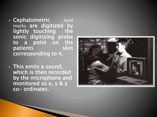 Cephalometric land
marks are digitized by
lightly touching the
sonic digitizing probe
to a point on the
patients skin
corresponding to it.
 This emits a sound,
which is then recorded
by the microphone and
monitored as x, y & z
co- ordinates.
 
