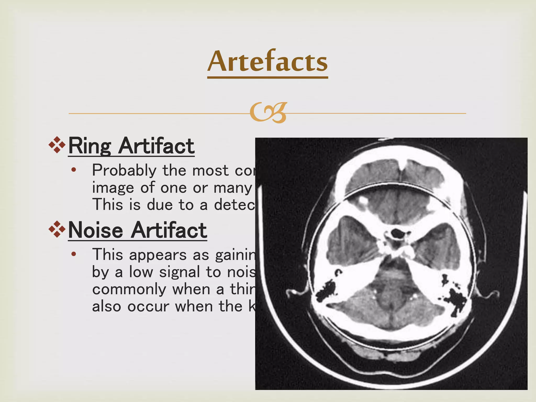 
Ring Artifact
• Probably the most common mechanical artifact, the
image of one or many 'rings' appears within an image.
This is due to a detector fault.
Noise Artifact
• This appears as gaining on the image and is caused
by a low signal to noise ratio. This occurs more
commonly when a thin slice thickness is used. It can
also occur when the kV or mA is too low.
Artefacts
 