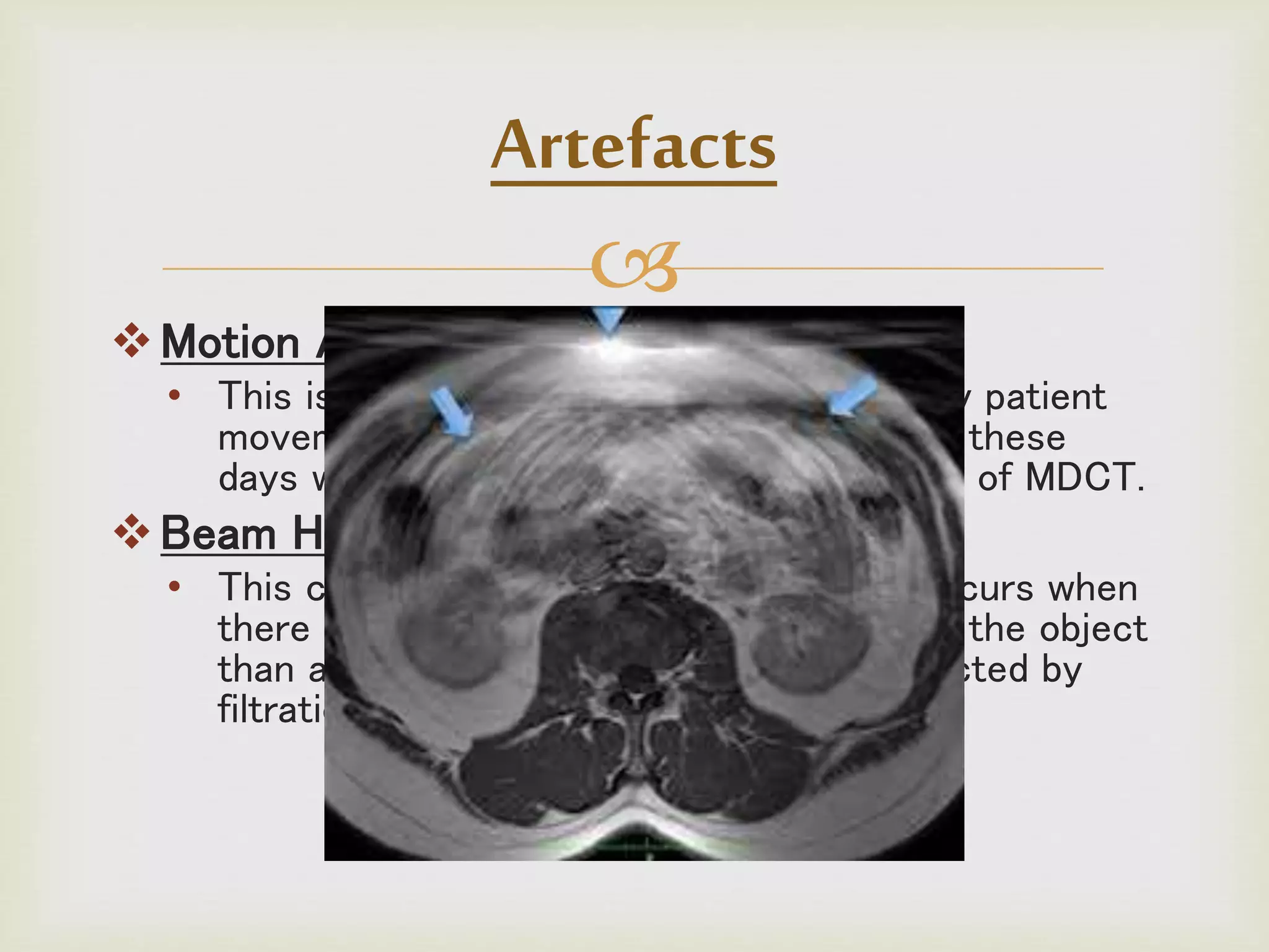 
Motion Artifact
• This is seen as blurring which is caused by patient
movement. This is not so much a problem these
days with faster scanning times in the use of MDCT.
Beam Hardening
• This can give a 'cupped appearance'. It occurs when
there is more attenuation in the center of the object
than around the edge. This is easily corrected by
filtration .
Artefacts
 