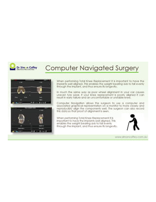 Computer Navigated Surgery