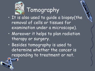 Tomography
• It is also used to guide a biopsy(the
removal of cells or tissues for
examination under a microscope).
• Moreover it helps to plan radiation
therapy or surgery.
• Besides tomography is used to
determine whether the cancer is
responding to treatment or not.
 