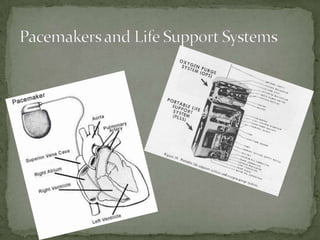 Pacemakers and Life Support Systems<br />