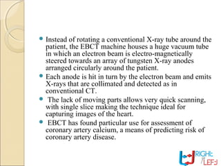  Instead of rotating a conventional X-ray tube around the
patient, the EBCT machine houses a huge vacuum tube
in which an electron beam is electro-magnetically
steered towards an array of tungsten X-ray anodes
arranged circularly around the patient.
 Each anode is hit in turn by the electron beam and emits
X-rays that are collimated and detected as in
conventional CT.
 The lack of moving parts allows very quick scanning,
with single slice making the technique ideal for
capturing images of the heart.
 EBCT has found particular use for assessment of
coronary artery calcium, a means of predicting risk of
coronary artery disease.
 