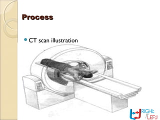 ProcessProcess
CT scan illustration
 