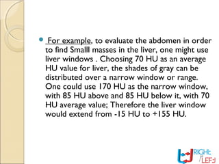  For example, to evaluate the abdomen in order
to find Smalll masses in the liver, one might use
liver windows . Choosing 70 HU as an average
HU value for liver, the shades of gray can be
distributed over a narrow window or range.
One could use 170 HU as the narrow window,
with 85 HU above and 85 HU below it, with 70
HU average value; Therefore the liver window
would extend from -15 HU to +155 HU.
 