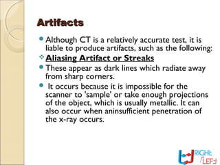 ArtifactsArtifacts
Although CT is a relatively accurate test, it is
liable to produce artifacts, such as the following:
Aliasing Artifact or Streaks
These appear as dark lines which radiate away
from sharp corners.
 It occurs because it is impossible for the
scanner to 'sample' or take enough projections
of the object, which is usually metallic. It can
also occur when aninsufficient penetration of
the x-ray occurs.
 