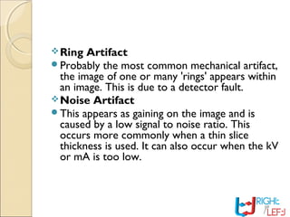 Ring Artifact
Probably the most common mechanical artifact,
the image of one or many 'rings' appears within
an image. This is due to a detector fault.
Noise Artifact
This appears as gaining on the image and is
caused by a low signal to noise ratio. This
occurs more commonly when a thin slice
thickness is used. It can also occur when the kV
or mA is too low.
 
