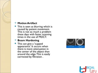 Motion Artifact
 This is seen as blurring which is
caused by patient movement.
This is not so much a problem
these days with faster scanning
times in the use of MDCT.
 Beam Hardening
 This can give a 'cupped
appearance'. It occurs when
there is more attenuation in
the center of the object than
around the edge.This is easily
corrected by filtration .
 