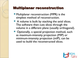 Multiplanar reconstructionMultiplanar reconstruction
Multiplanar reconstruction (MPR) is the
simplest method of reconstruction.
 A volume is built by stacking the axial slices.
The software then cuts slices through the
volume in a different plane (usually orthogonal).
 Optionally, a special projection method, such
as maximum-intensity projection (MIP) or
minimum-intensity projection (mIP), can be
used to build the reconstructed slices.
 