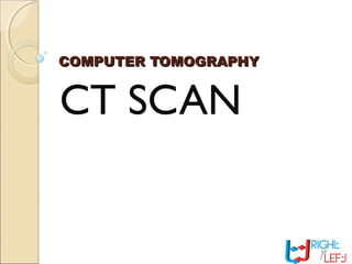 COMPUTER TOMOGRAPHYCOMPUTER TOMOGRAPHY
CT SCAN
 