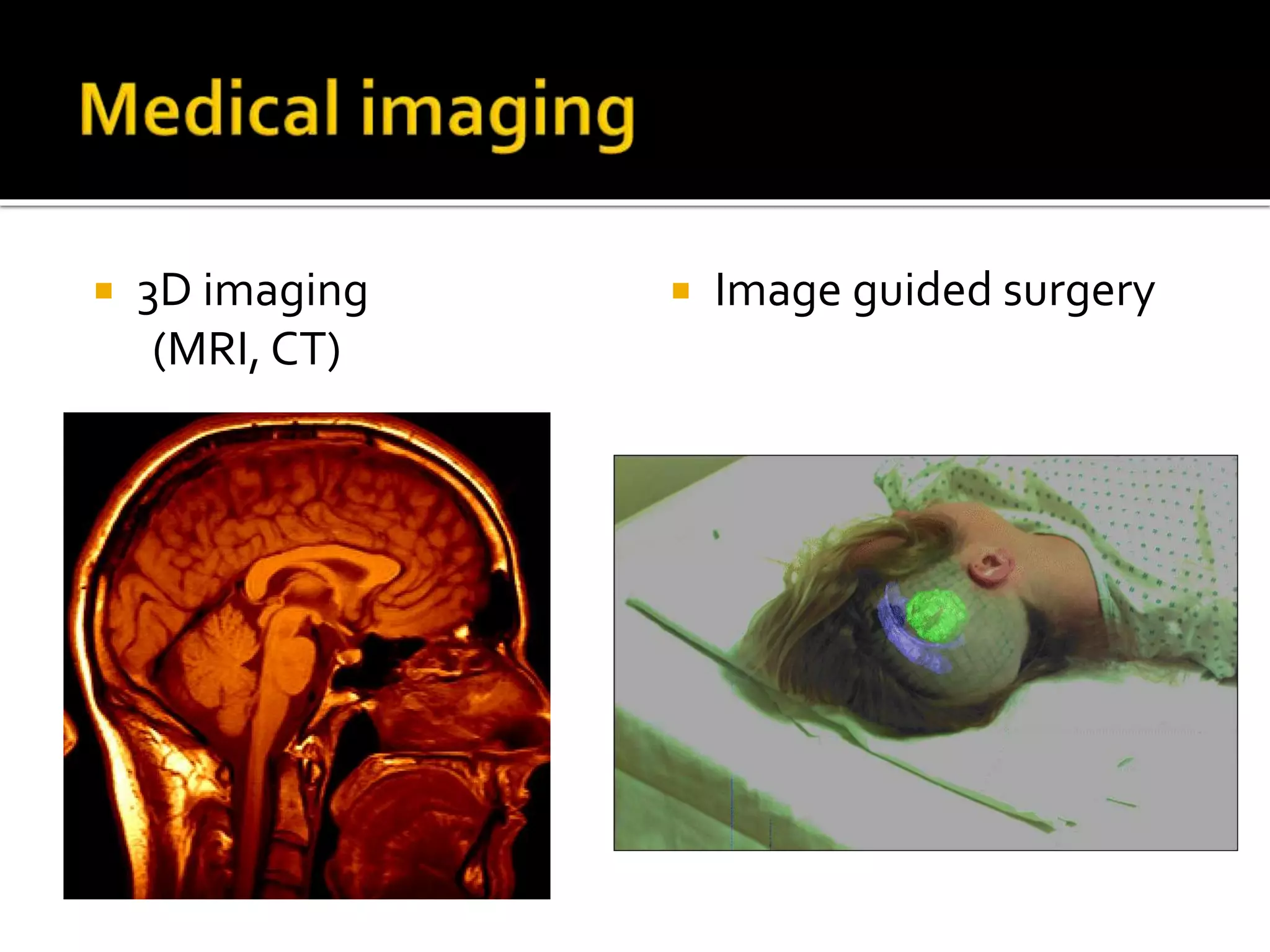  3D imaging
(MRI, CT)
 Image guided surgery
 