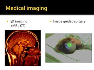  3D imaging
(MRI, CT)
 Image guided surgery
 