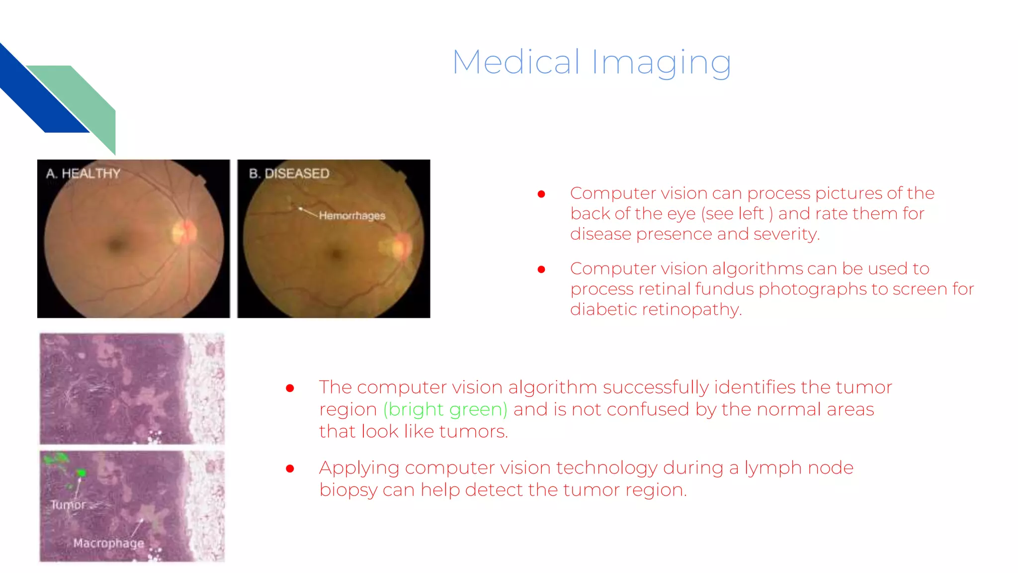 Medical Imaging
● Computer vision can process pictures of the
back of the eye (see left ) and rate them for
disease presence and severity.
● Computer vision algorithms can be used to
process retinal fundus photographs to screen for
diabetic retinopathy.
● The computer vision algorithm successfully identifies the tumor
region (bright green) and is not confused by the normal areas
that look like tumors.
● Applying computer vision technology during a lymph node
biopsy can help detect the tumor region.
 