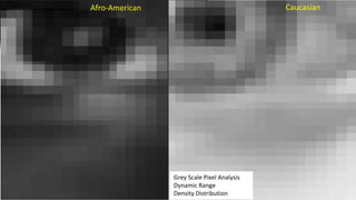 22
Afro-American Caucasian
Grey Scale Pixel Analysis
Dynamic Range
Density Distribution
 