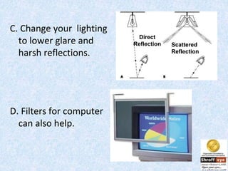 Computer vision syndrome | PPT