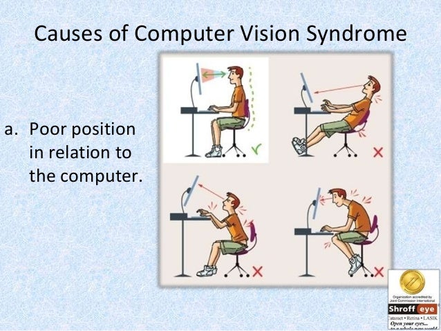characteristics of computer vision syndrome Go to eye diseases computer vision syndrome computer vision syndrome describes a group of eye and vision-related problems that result from prolonged computer use. characteristics of computer vision syndrome Go to eye diseases computer vision syndrome computer vision syndrome describes a group of eye and vision-related problems that result from prolonged computer use.