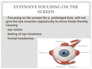 EXTENSIVE FOCUSING ON THE
SCREEN
• Focusing on the screen for a prolonged time will not
give the eye muscles opportunity to move freely thereby
causing
eye aches
feeling of eye tiredness
frontal headaches.
 