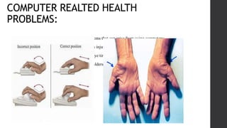 Computer Related Health Problem computer vision syndrome presentation.pptx