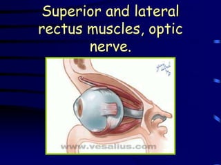 Superior and lateral
rectus muscles, optic
       nerve.
 