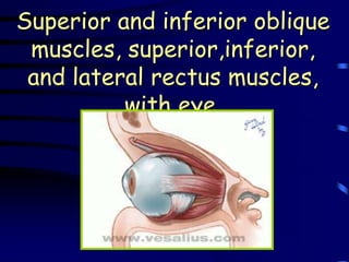 Superior and inferior oblique
 muscles, superior,inferior,
 and lateral rectus muscles,
          with eye.
 