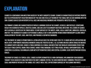 Explanation 
Scabies is a contagious skin infection caused by the mite Sarcoptes scabiei. Scabies is characterized by intense pruritis 
due to a hypersensitivity reaction induced by the eggs and feces left behind by the female mite as she burrows into the 
skin. Scabies can be seen in patients of all ages and household members are frequently infected as well. 
The primary lesions are characterized by papules, burrows (seen in the exhibit), vesicles, and pustules. Scratching 
results in excoriated papules, crusted lesions, and can lead to secondary bacterial infection. The lesions of scabies 
are classically located on the finger webs, flexor surfaces of the wrists, arms, axilla, waistline, umbilicus, genitalia, 
and feet. The diagnosis of scabies is often made clinically, but a skin scraping viewed under microscopy allows direct 
visualization of the mite, eggs, and feces, and provides a definitive diagnosis. 
The treatment of choice is permethrin 5% lotion applied over the entire body for 8 to 12 hours with re-application one 
week later. Symptomatic household members should be treated as well. All clothing and bed linens should be washed 
to eliminate mites and eggs. Choice A (Tinea corporis) is a fungal skin infection that involves skin regions other than 
the scalp (tinea capitis), groin (tinea cruris), hands (tinea manuum), feet (tinea pedis), or nails (onychomycosis). The 
condition is classically an annular lesion with erythematous edges and central clearing. Close inspection may reveal 
scales. 
Treatment of choice is a topical azole. Choice B (Atopic dermatitis) is a non-contagious, inflammatory skin disorder 
thought to be caused by a malfunction in the body’s immune system. The skin condition most commonly presents as dry, 
scaly, and pruritic patches of the hands, feet, chest, neck, face, or posterior surfaces of the elbows and knees. 
Provided by COMQUEST Osteopathic Specialists. 
 