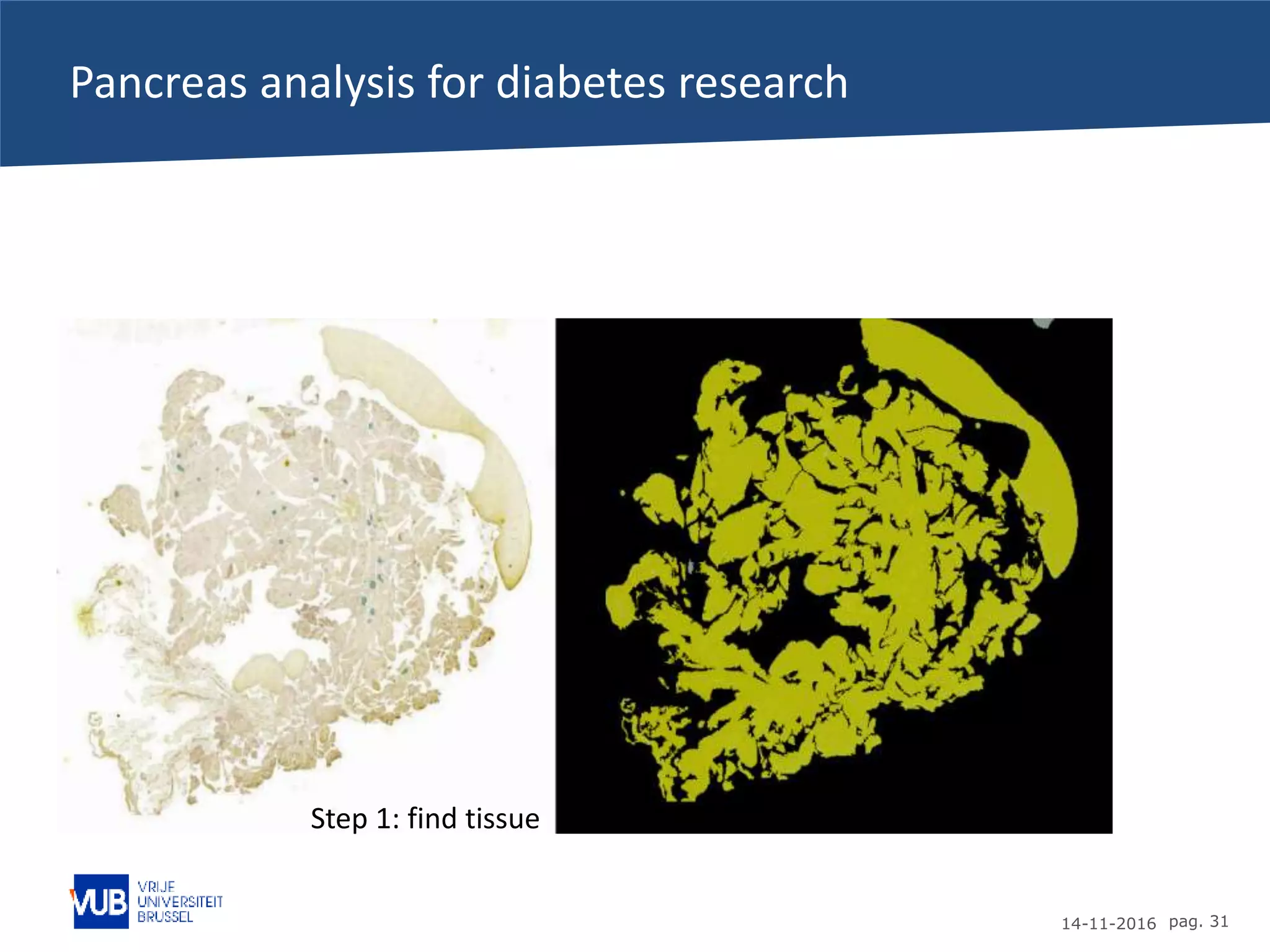 14-11-2016 pag. 31
Pancreas analysis for diabetes research
Step 1: find tissue
 