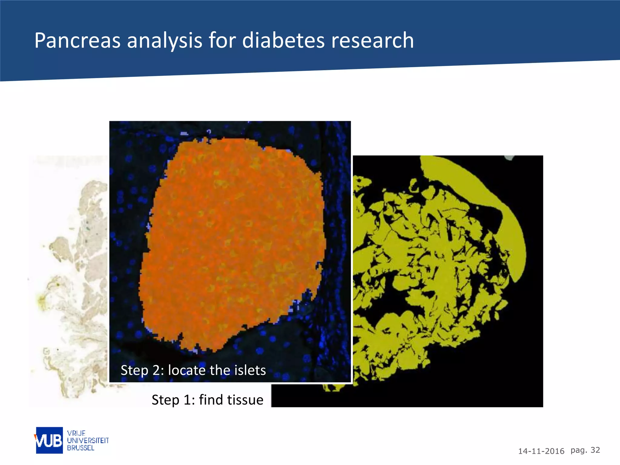 14-11-2016 pag. 32
Pancreas analysis for diabetes research
Step 1: find tissue
Step 2: locate the islets
 