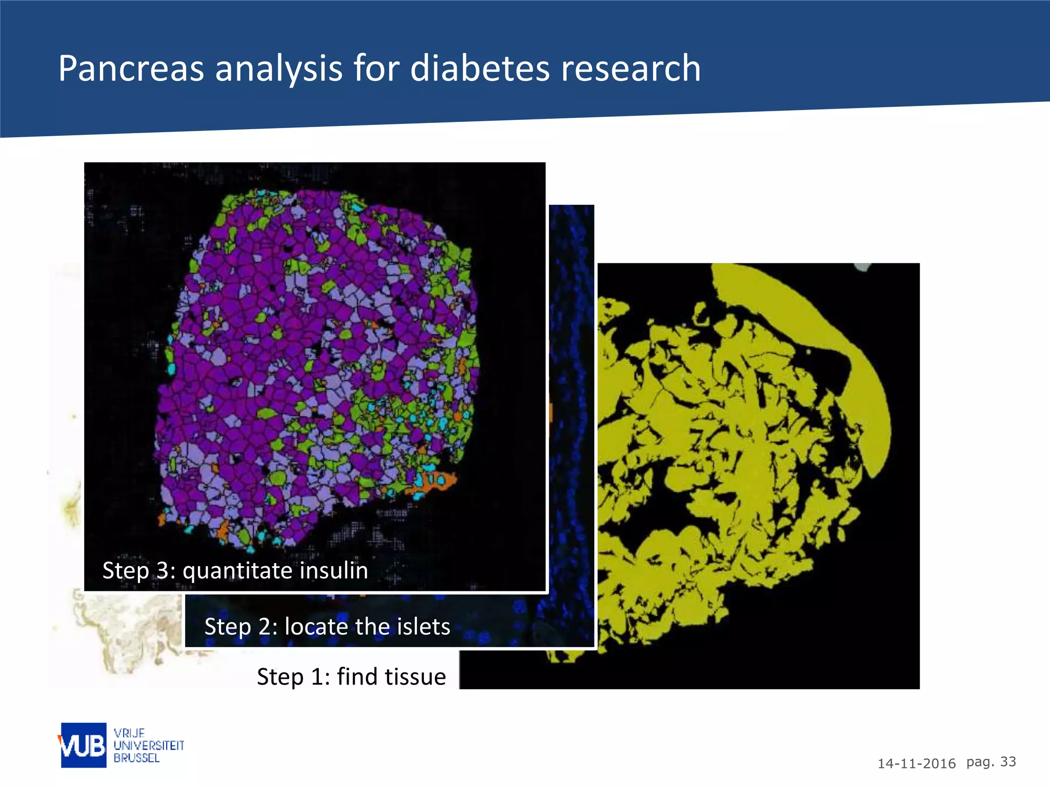 14-11-2016 pag. 33
Pancreas analysis for diabetes research
Step 1: find tissue
Step 2: locate the islets
Step 3: quantitate insulin
 