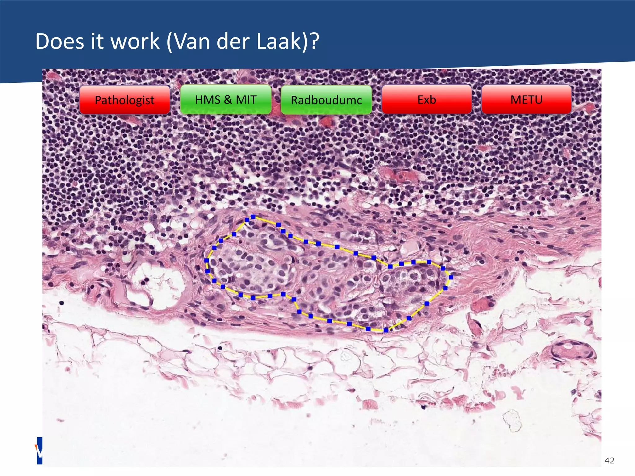 14-11-2016 pag. 42
Does it work (Van der Laak)?
Pathologist Exb METURadboudumcHMS & MIT
 