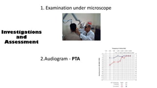 Investigations
and
Assessment
1. Examination under microscope
2.Audiogram - PTA
 