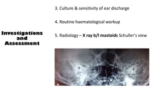 3. Culture & sensitivity of ear discharge
4. Routine haematological workup
5. Radiology – X ray b/l mastoids Schuller's view
Investigations
and
Assessment
 
