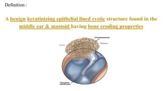 Definition :
A benign keratinizing epithelial lined cystic structure found in the
middle ear & mastoid having bone eroding properties
 