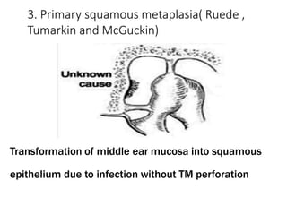 3. Primary squamous metaplasia( Ruede ,
Tumarkin and McGuckin)
Transformation of middle ear mucosa into squamous
epithelium due to infection without TM perforation
 