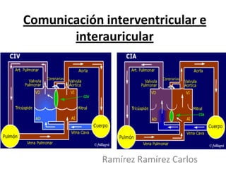 Comunicación interventricular e
       interauricular




             Ramírez Ramírez Carlos
 