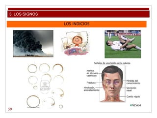 LOS INDICIOS
59
3. LOS SIGNOS
 