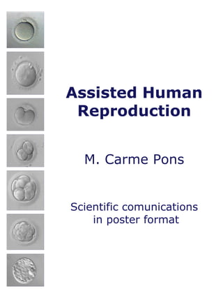 M. Carme Pons
Assisted Human
Reproduction
Scientific comunications
in poster format
Scientific comunications
in poster format
 
